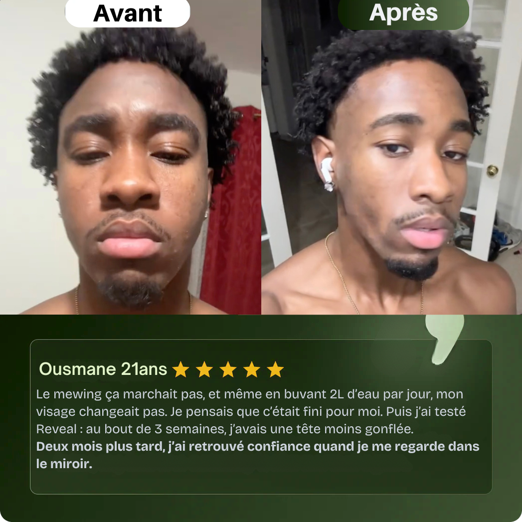 Reveal - Masque Jawline